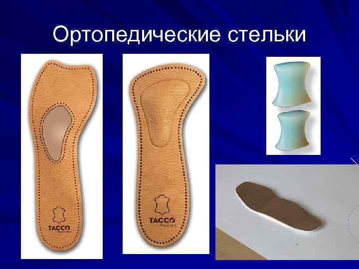 Ортопедические стельки 