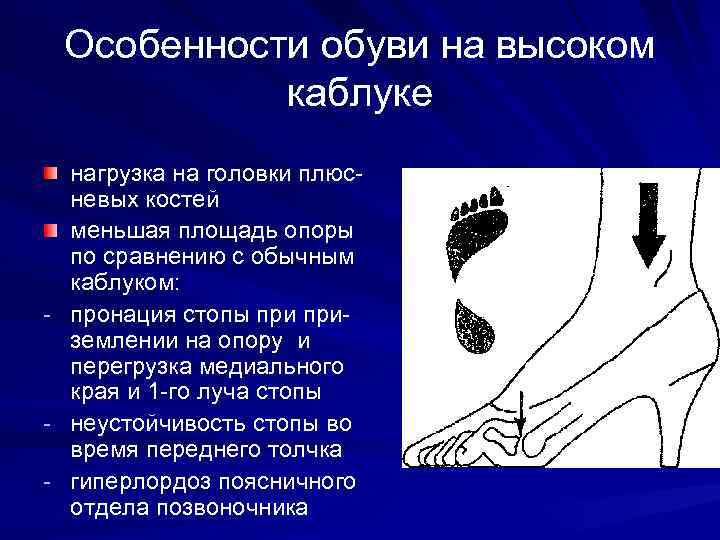Особенности обуви на высоком каблуке нагрузка на головки плюсневых костей меньшая площадь опоры по