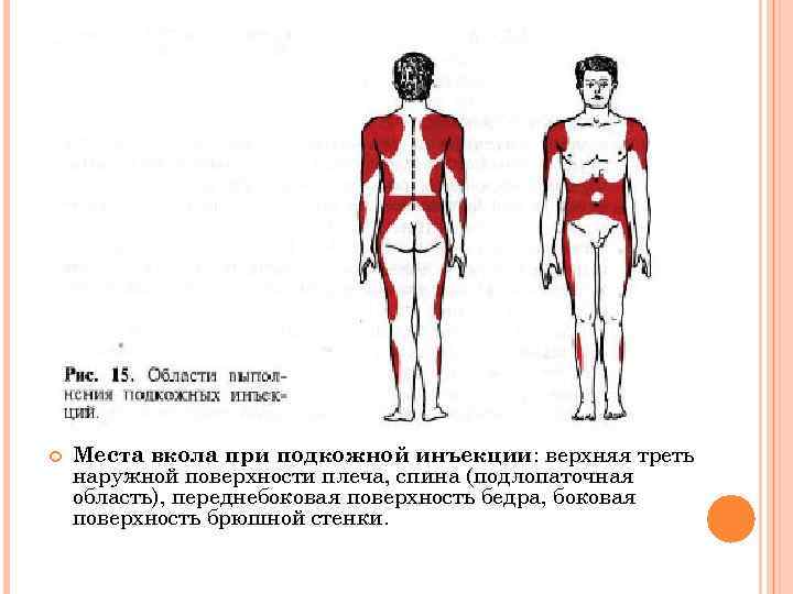 Отметьте на рисунке места для подкожных и внутрикожных инъекций цветными чернилами