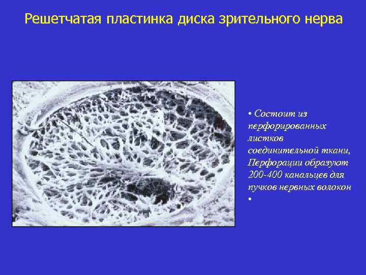 Решетчатая пластинка диска зрительного нерва • Состоит из перфорированных листков соединительной ткани, Перфорации образуют