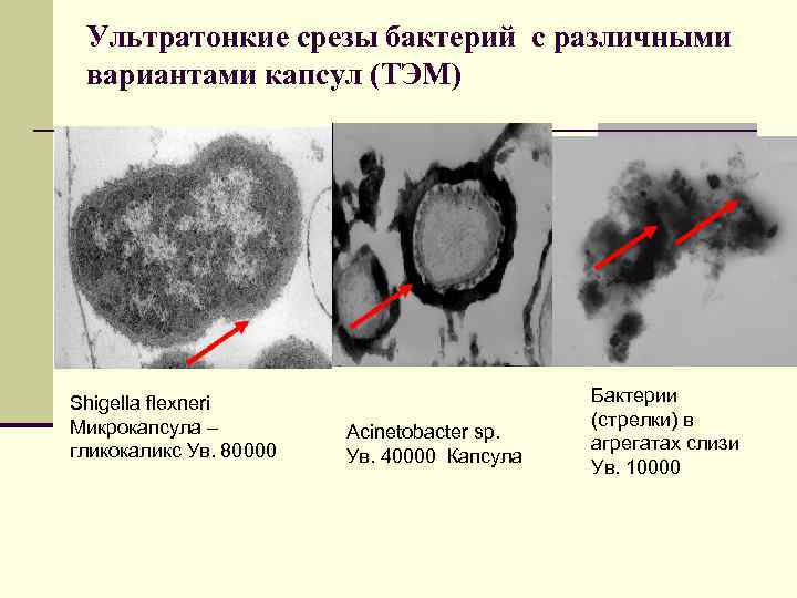 Ультратонкие срезы бактерий с различными вариантами капсул (ТЭМ) Shigella flexneri Микрокапсула – гликокаликс Ув.