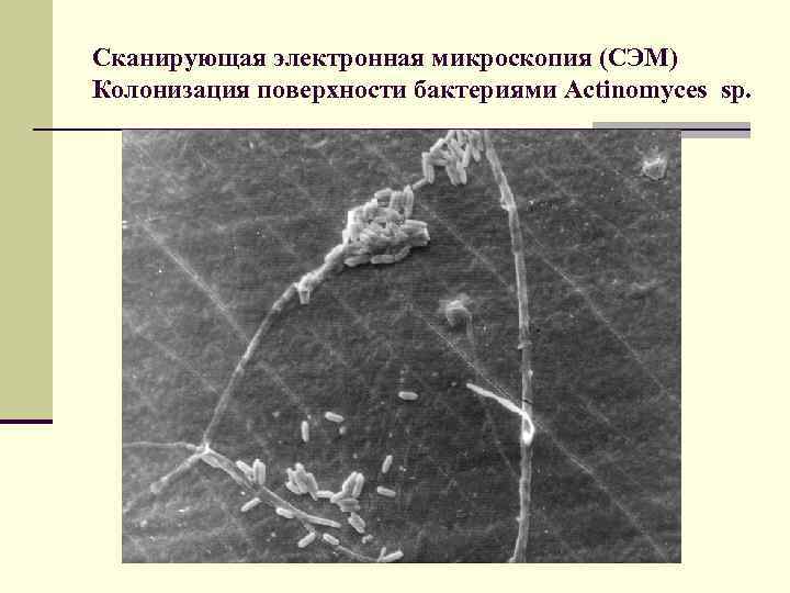 Сканирующая электронная микроскопия (СЭМ) Колонизация поверхности бактериями Actinomyces sp. 