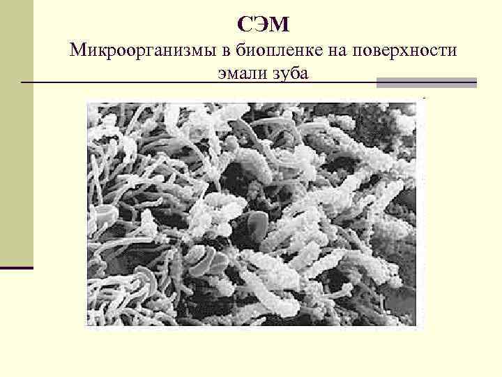 СЭМ Микроорганизмы в биопленке на поверхности эмали зуба 