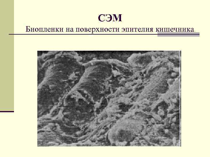 СЭМ Биопленки на поверхности эпителия кишечника 