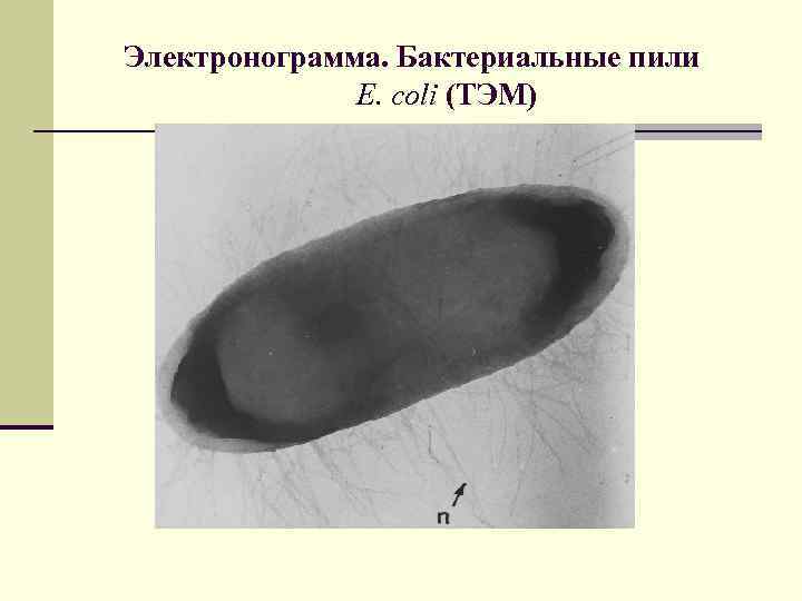Электронограмма. Бактериальные пили E. coli (ТЭМ) 