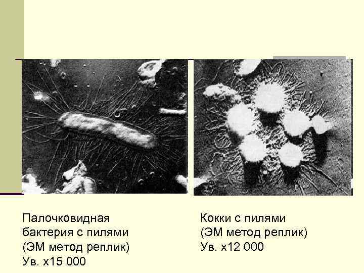Палочковидная бактерия с пилями (ЭМ метод реплик) Ув. х15 000 Кокки с пилями (ЭМ