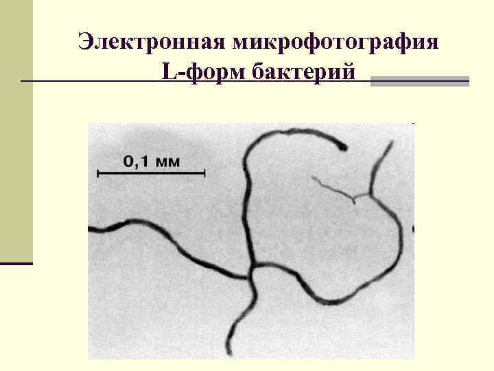 Электронная микрофотография L-форм бактерий 