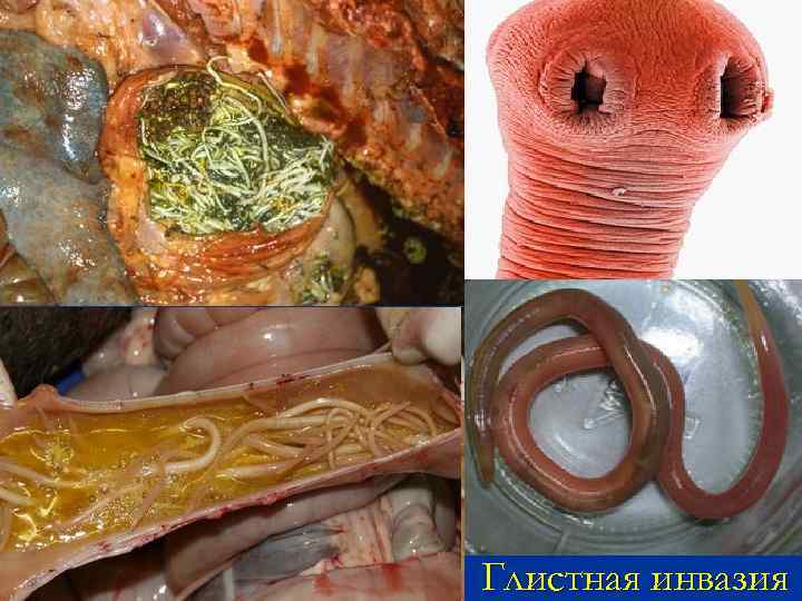 Глистная инвазия 