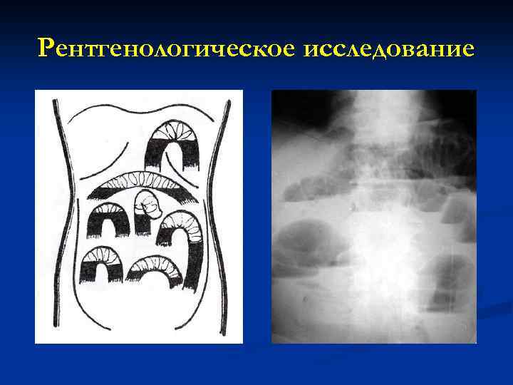 Рентгенологическое исследование 
