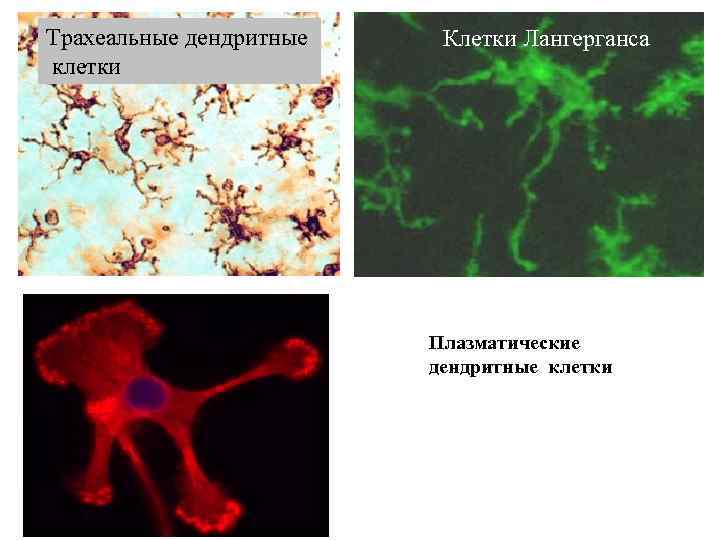 Трахеальные дендритные Клетки Лангерганса клетки Плазматические дендритные клетки In-vitro differentiated monocyte-derived Dendritic Cell 