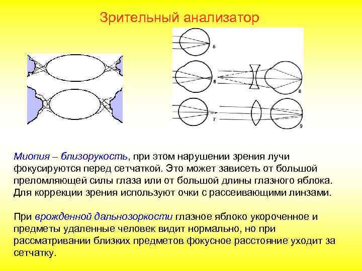  Зрительный анализатор Миопия – близорукость, при этом нарушении зрения лучи фокусируются перед сетчаткой.
