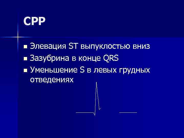 СРР n Элевация ST выпуклостью вниз n Зазубрина в конце QRS n Уменьшение S