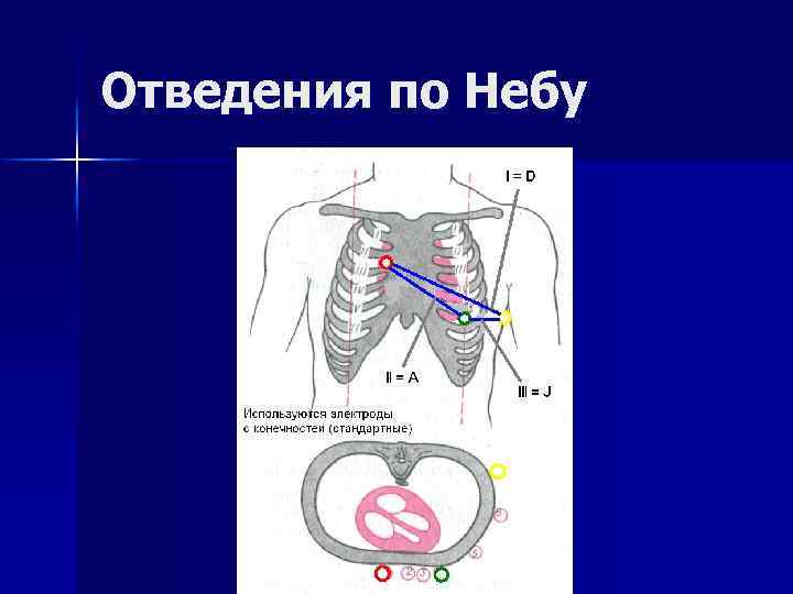 Отведения по Небу 