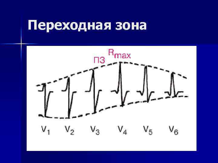 Переходная зона 