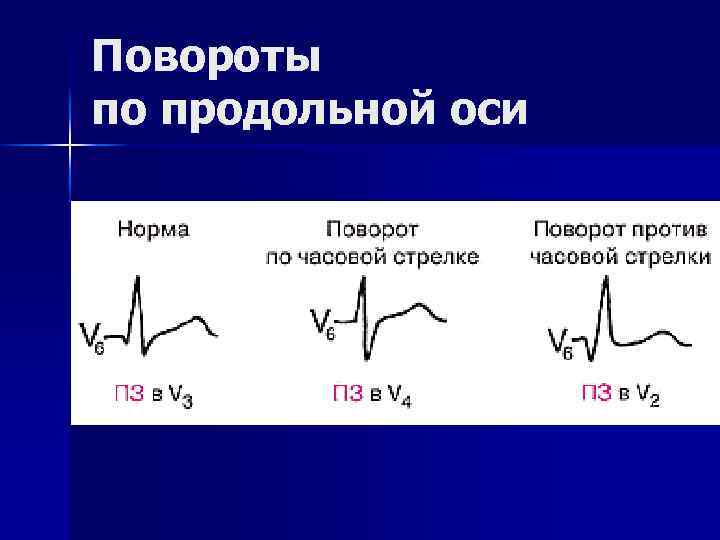 Повороты по продольной оси 