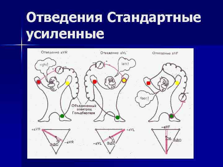 Отведения Стандартные усиленные 