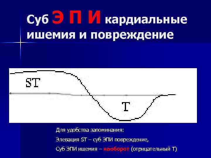 Суб Э П И кардиальные ишемия и повреждение Для удобства запоминания: Элевация ST –