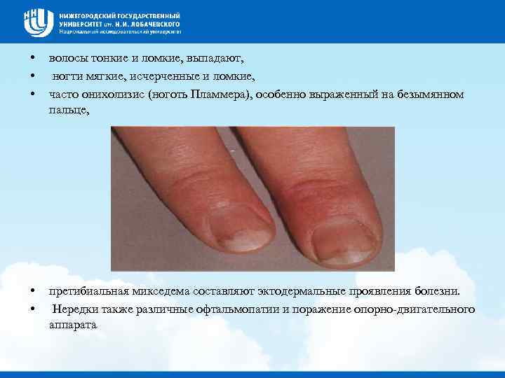  •  волосы тонкие и ломкие, выпадают,  • ногти мягкие, исчерченные и