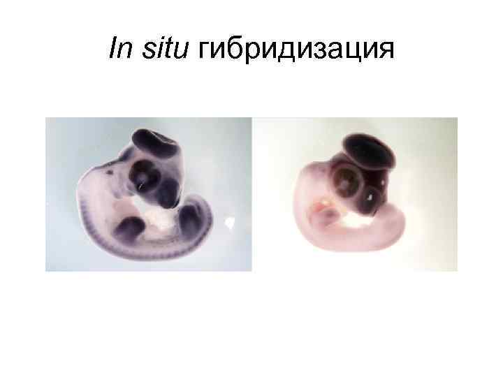 In situ гибридизация In situ гибридизация