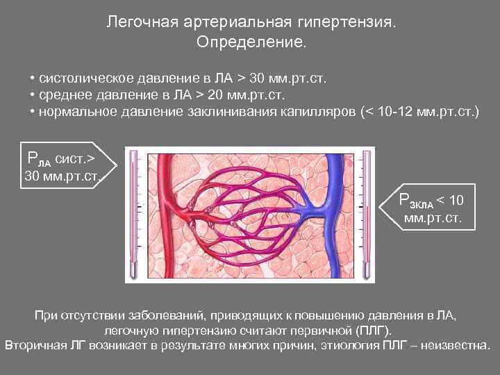 Легочная артериальная гипертензия презентация