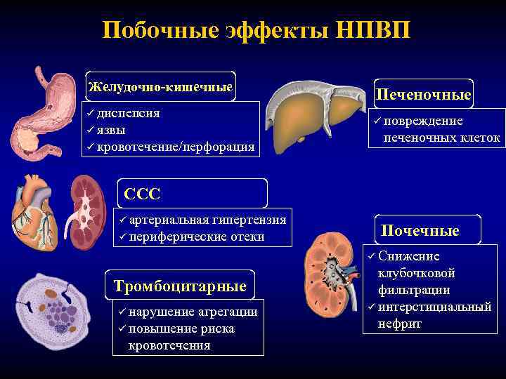 Побочные эффекты НПВП Желудочно-кишечные ü диспепсия ü язвы ü кровотечение/перфорация Печеночные ü повреждение печеночных
