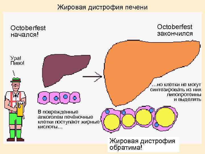 Жировая дистрофия печени Octoberfest начался! Octoberfest закончился Ура! Пиво! …но клетки не могут синтезировать