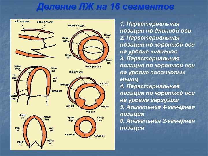   Стандартный 6 -фазовый протокол   введения добутамина Для выявления гибернирующего миокарда