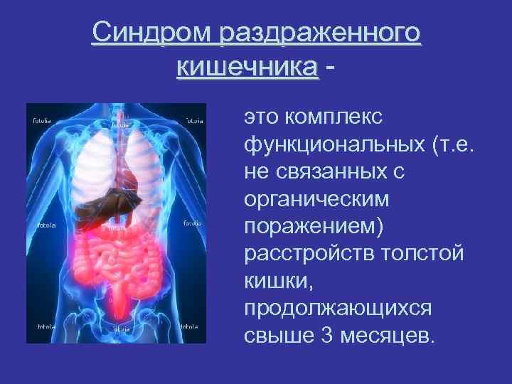 Синдром раздраженного  кишечника -  кишечника  это комплекс   функциональных (т.
