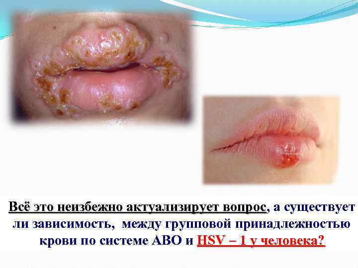 Всё это неизбежно актуализирует вопрос, а существует вопрос ли зависимость, между групповой принадлежностью крови