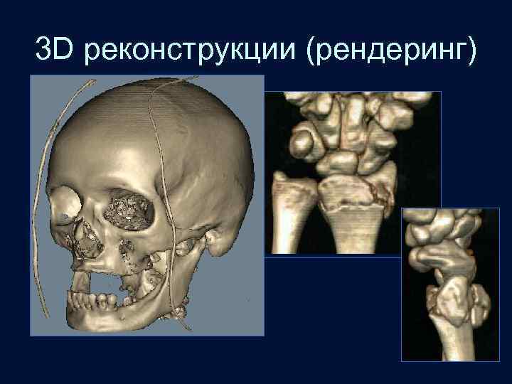 3 D реконструкции (рендеринг) 