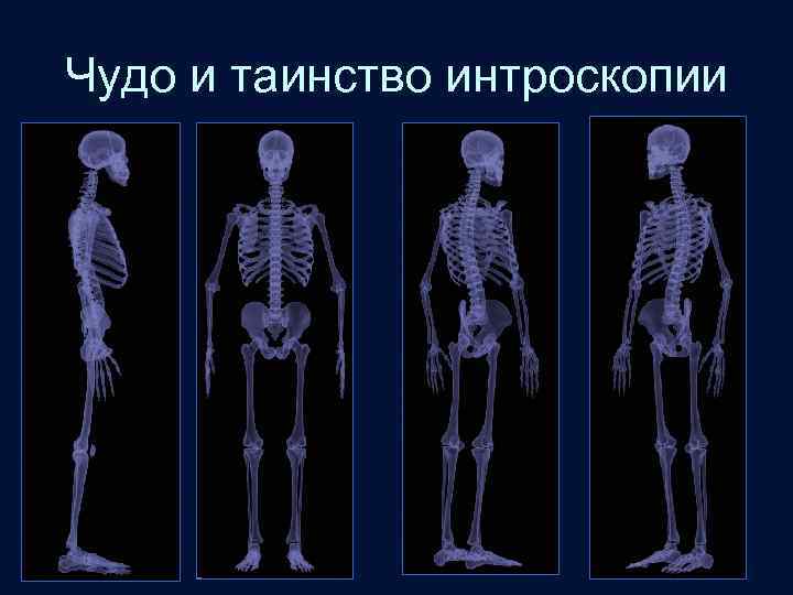 Чудо и таинство интроскопии 