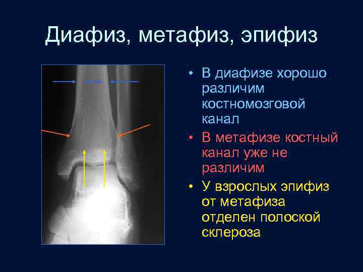 Диафиз, метафиз, эпифиз • В диафизе хорошо различим костномозговой канал • В метафизе костный