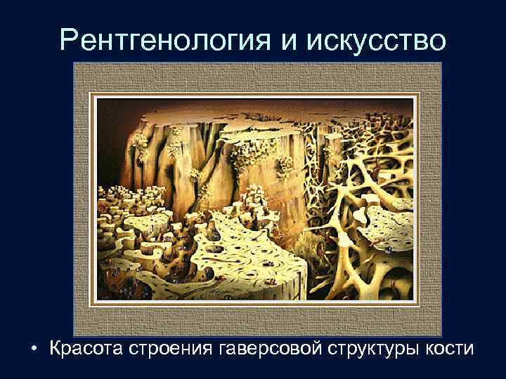 Рентгенология и искусство • Красота строения гаверсовой структуры кости 