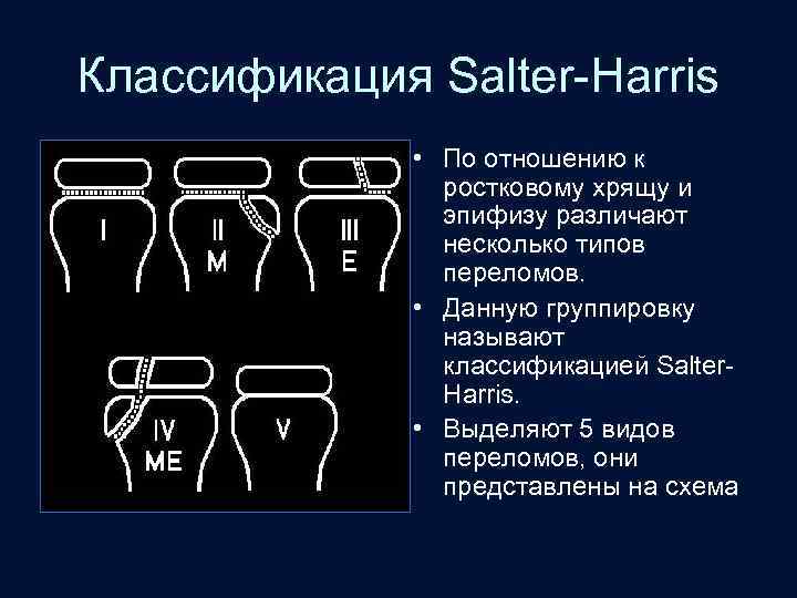 Классификация Salter-Harris • По отношению к ростковому хрящу и эпифизу различают несколько типов переломов.