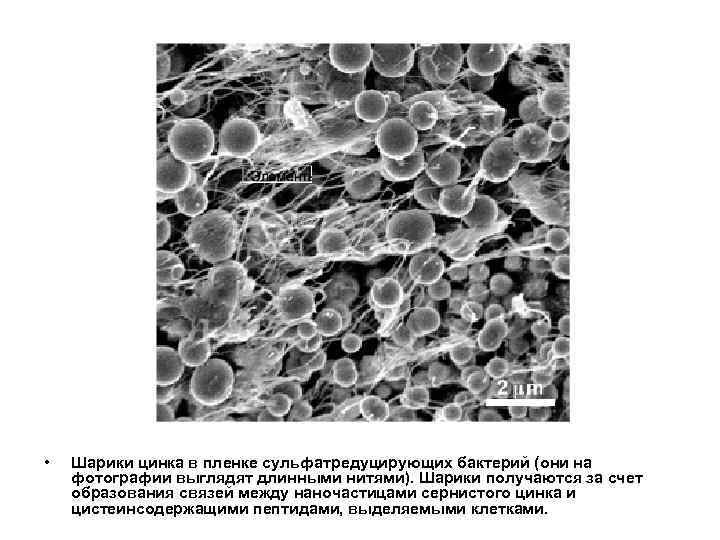  • Шарики цинка в пленке сульфатредуцирующих бактерий (они на фотографии выглядят длинными нитями).