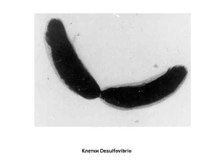 Клетки Desulfovibrio 