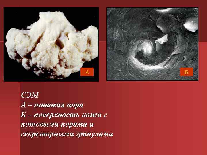 А Б СЭМ А – потовая пора А Б СЭМ А – потовая пора