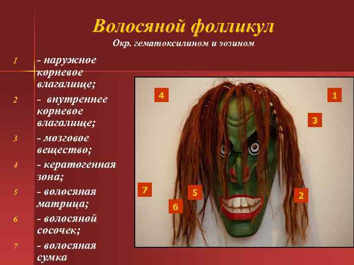 Волосяной фолликул Окр. гематоксилином и эозином 1 - Волосяной фолликул Окр. гематоксилином и эозином 1 -