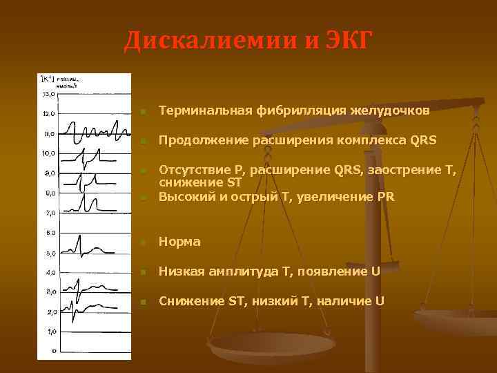 Дискалиемии и ЭКГ  n  Терминальная фибрилляция желудочков  n  Продолжение расширения