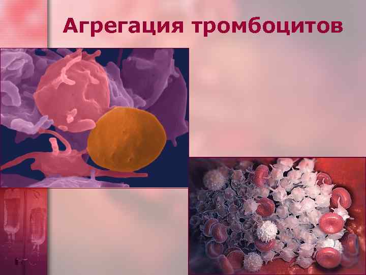 Агрегация тромбоцитов 