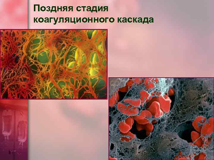Поздняя стадия коагуляционного каскада 