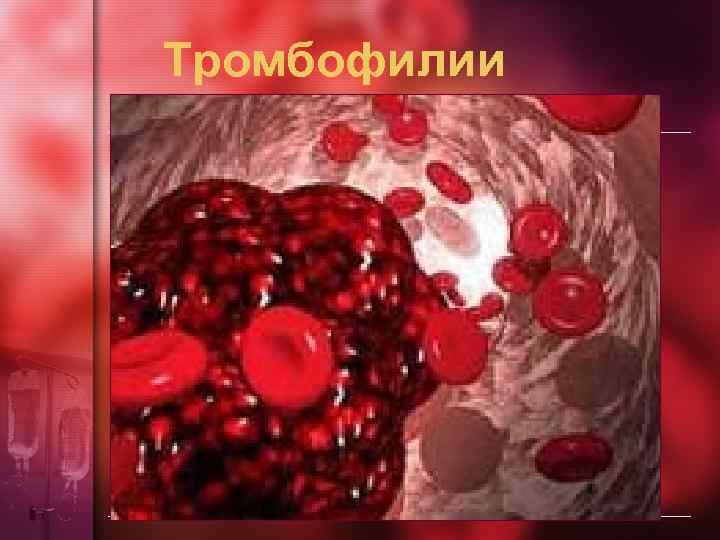 Тромбофилии 