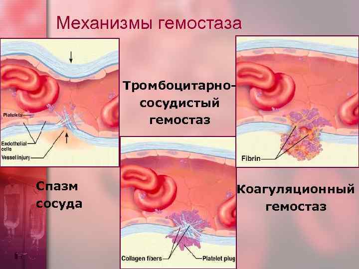  Механизмы гемостаза  Тромбоцитарно-  сосудистый   гемостаз Спазм   Коагуляционный