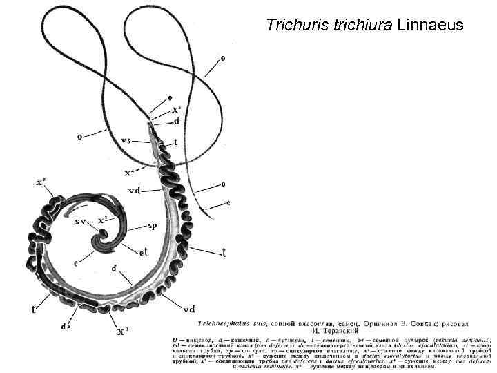 Trichuris trichiura Linnaeus 