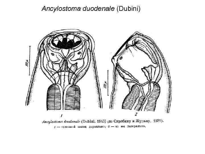 Ancylostoma duodenale (Dubini) 