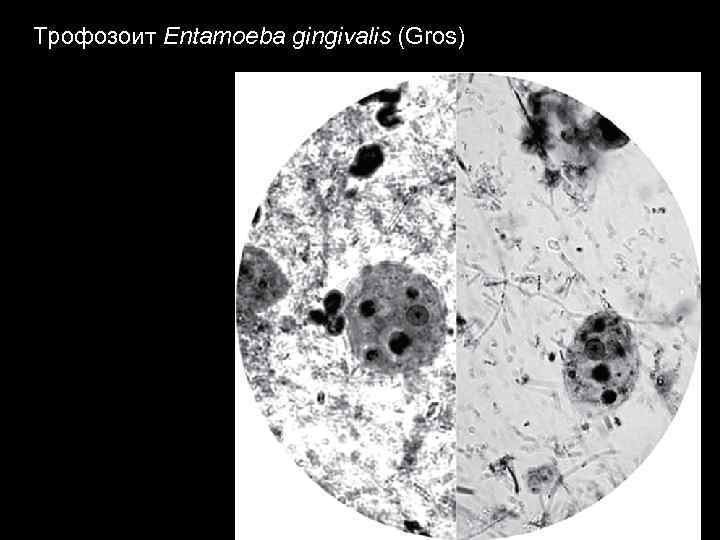 Трофозоит Entamoeba gingivalis (Gros) 
