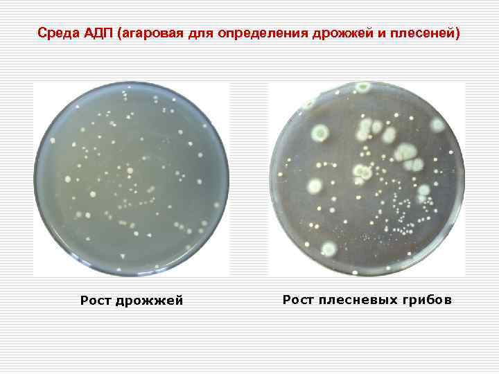 Среда АДП (агаровая для определения дрожжей и плесеней)   Рост дрожжей  