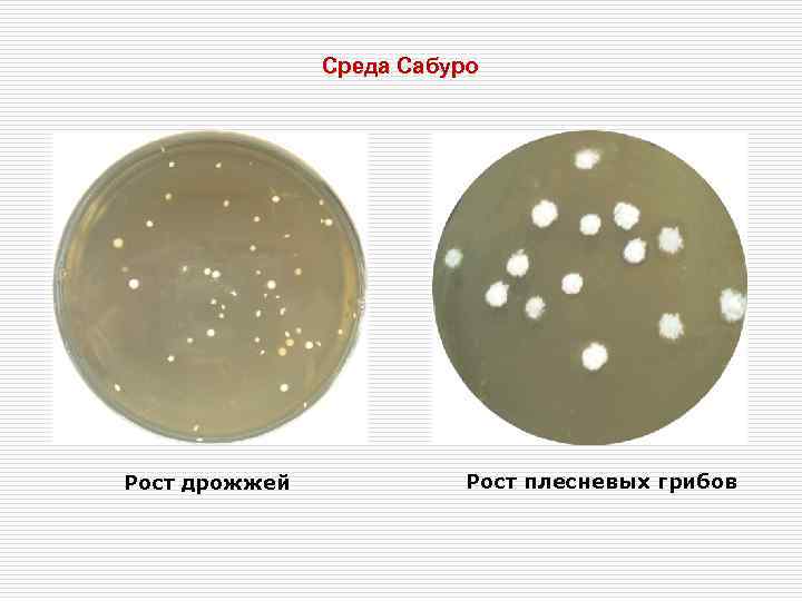     Среда Сабуро Рост дрожжей   Рост плесневых грибов 