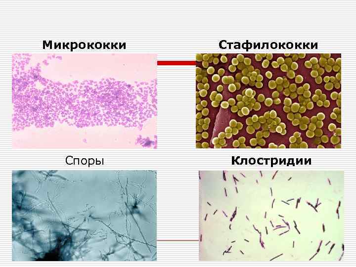 Микрококки  Стафилококки  Споры   Клостридии стрептомицетов 
