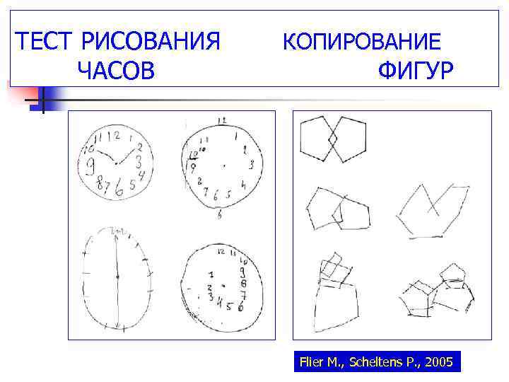 Фигуры часовые